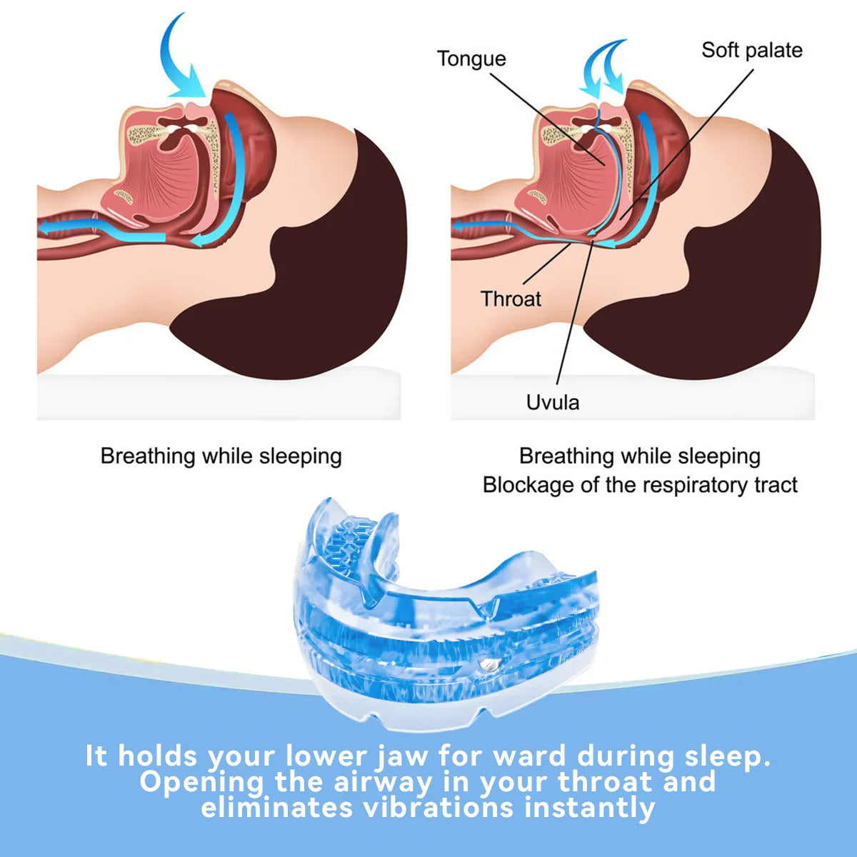 Anti-Snore Mouth Guard – photo 3