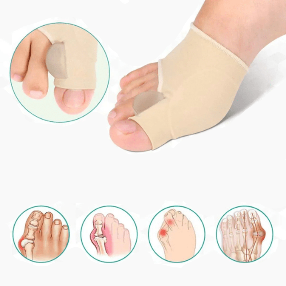 Bunion Corrector – photo 7