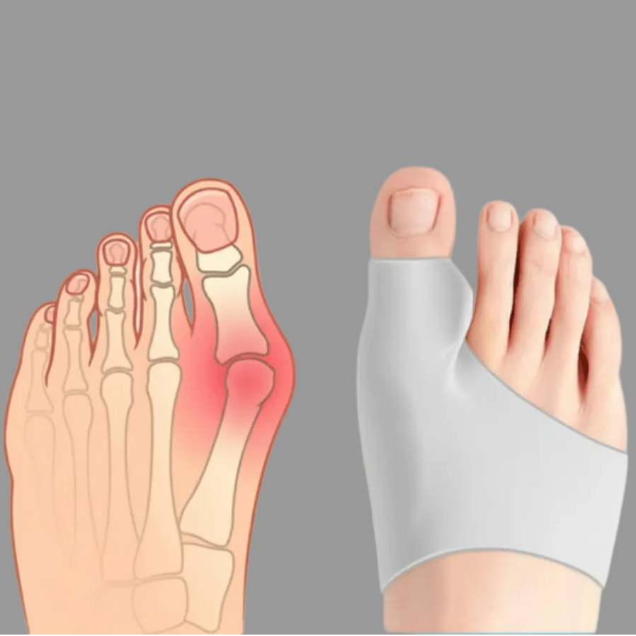 Bunion Corrector – photo 8
