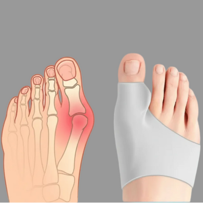 Bunion Corrector – photo 8