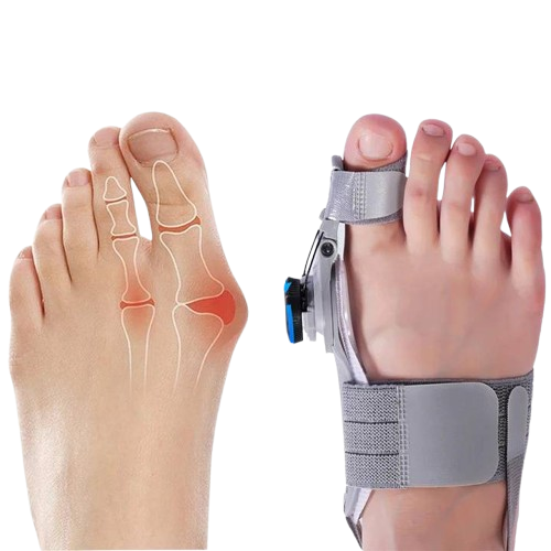 Bunion Toe Spacer