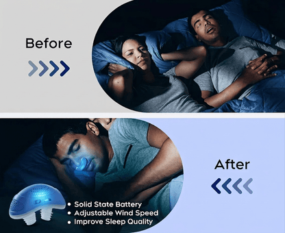 Mini Anti-Snoring Device – photo 3