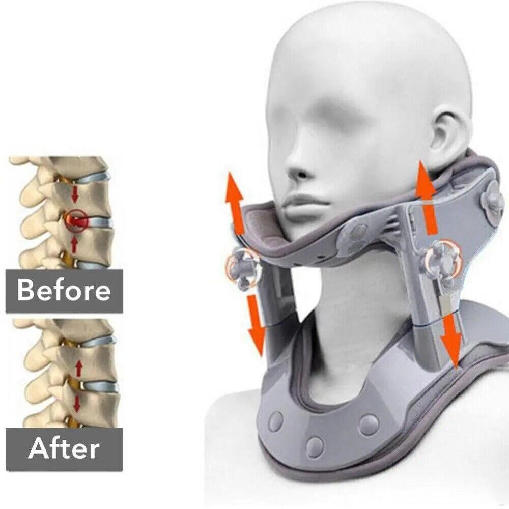 Neck Stretcher Traction Device – photo 15