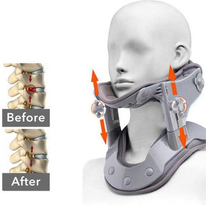 Neck Stretcher Traction Device – photo 15