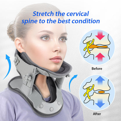 Neck Stretcher Traction Device – photo 3