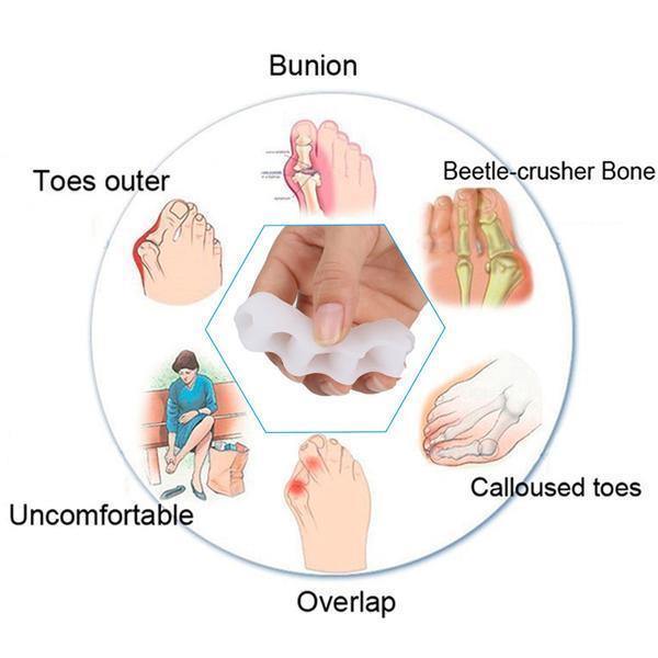 Orthopedic Toe Corrector – photo 3