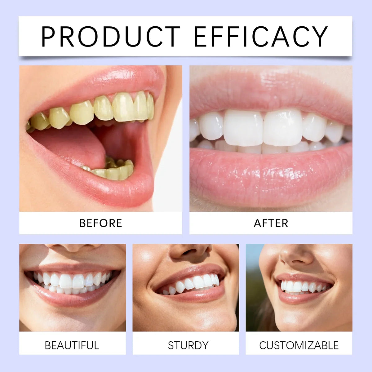 Purple Teeth Whitening Strips – photo 3