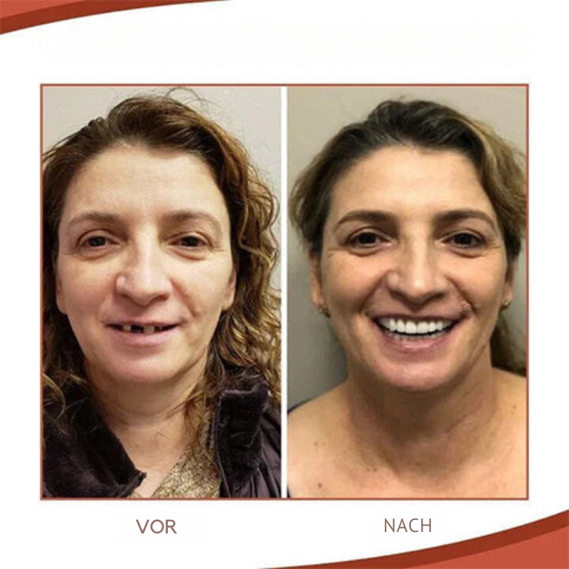 Silicone Dentures