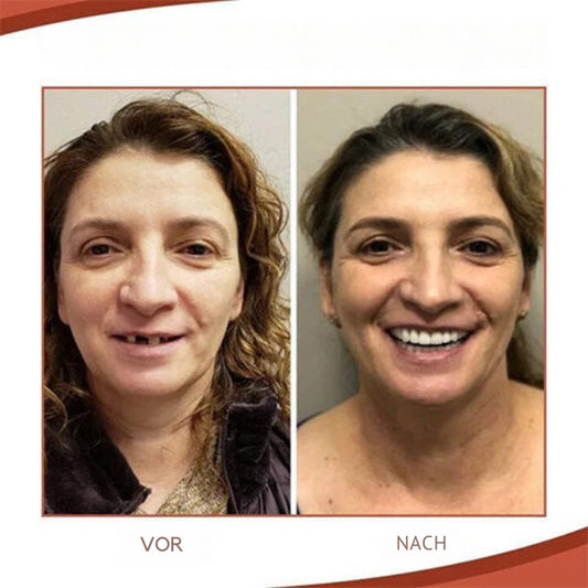 Silicone Dentures