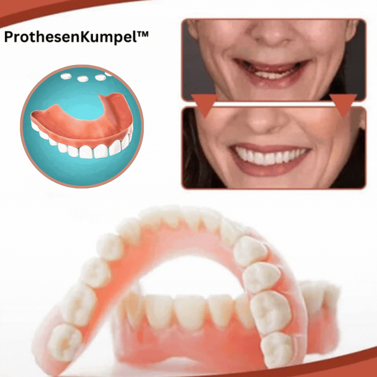 Silicone Dentures – photo 4