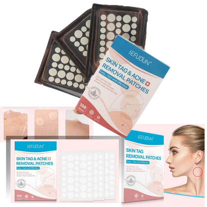 Skin Tag Removal Patches – photo 2