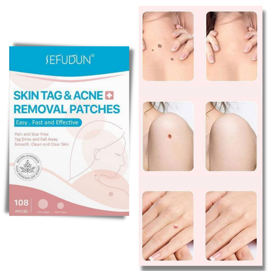 Skin Tag Removal Patches – photo 3