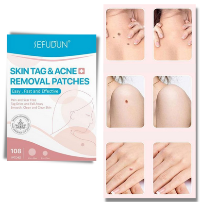 Skin Tag Removal Patches – photo 3