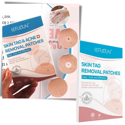 Skin Tag Removal Patches – photo 6