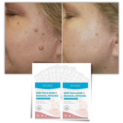 Skin Tag Removal Patches – photo 7