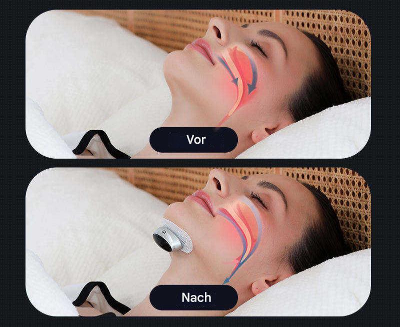 Nasal Anti-Snoring Device – photo 6