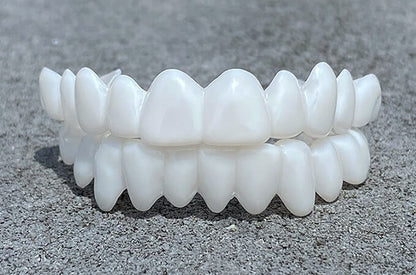 Removable Dental Veneers – photo 2