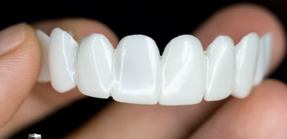 Removable Dental Veneers – photo 4