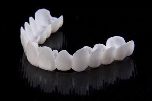 Removable Dental Veneers – photo 6