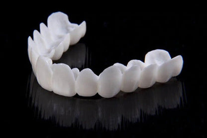 Removable Dental Veneers – photo 6