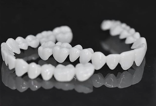Removable Dental Veneers – photo 7