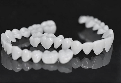 Removable Dental Veneers – photo 7
