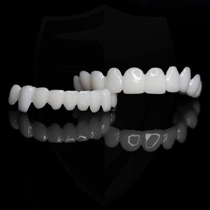 Removable Dental Veneers – photo 9