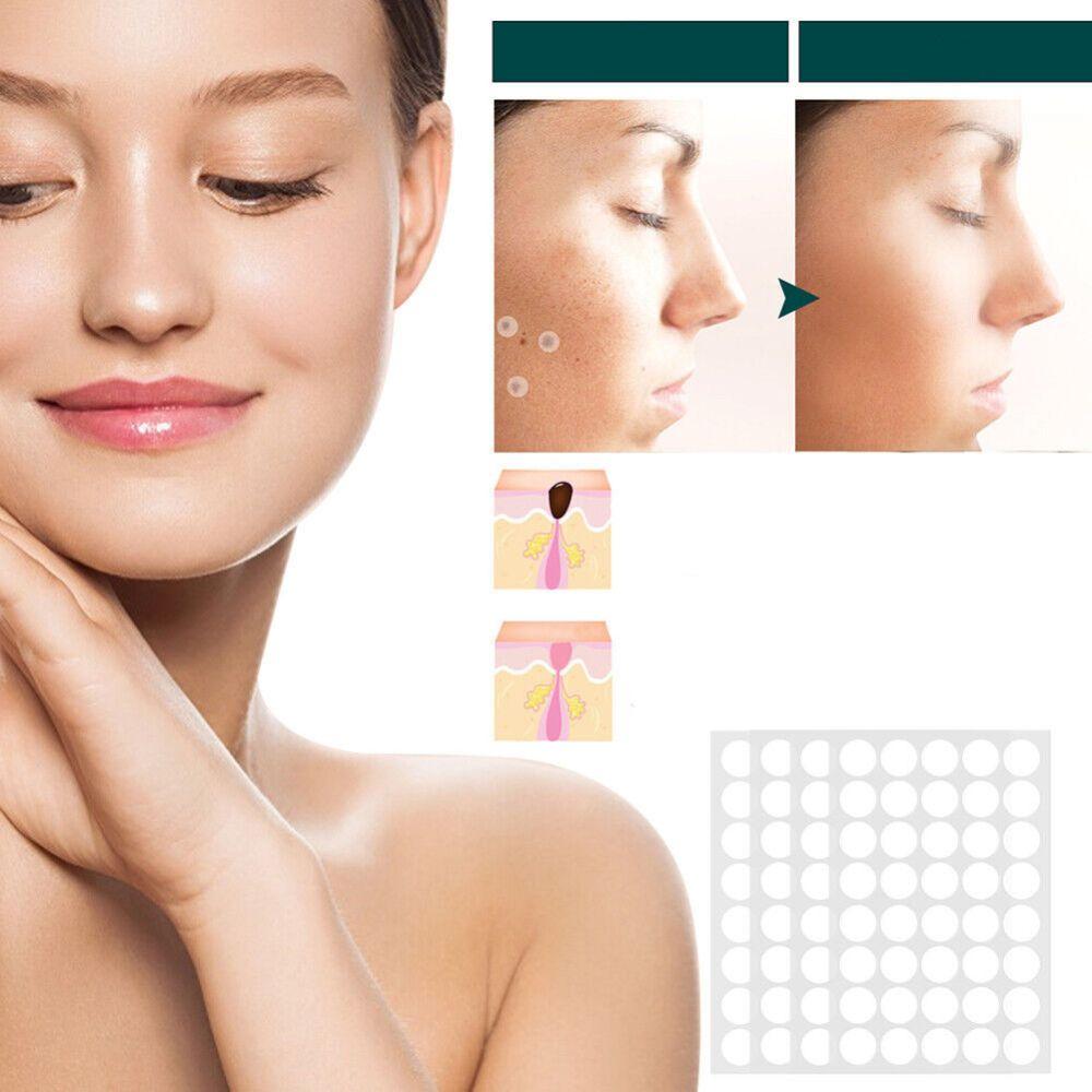 Wart Removal Patches – photo 4