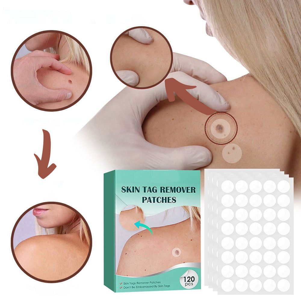 Wart Removal Patches – photo 5