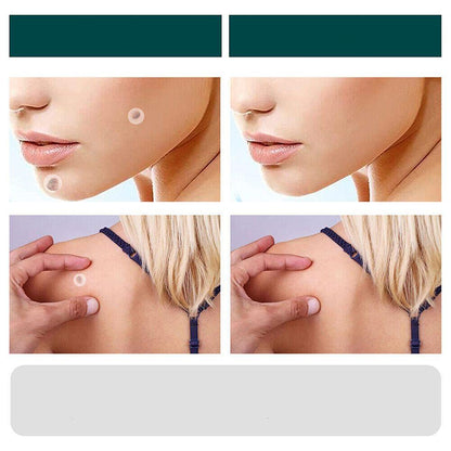 Wart Removal Patches – photo 6